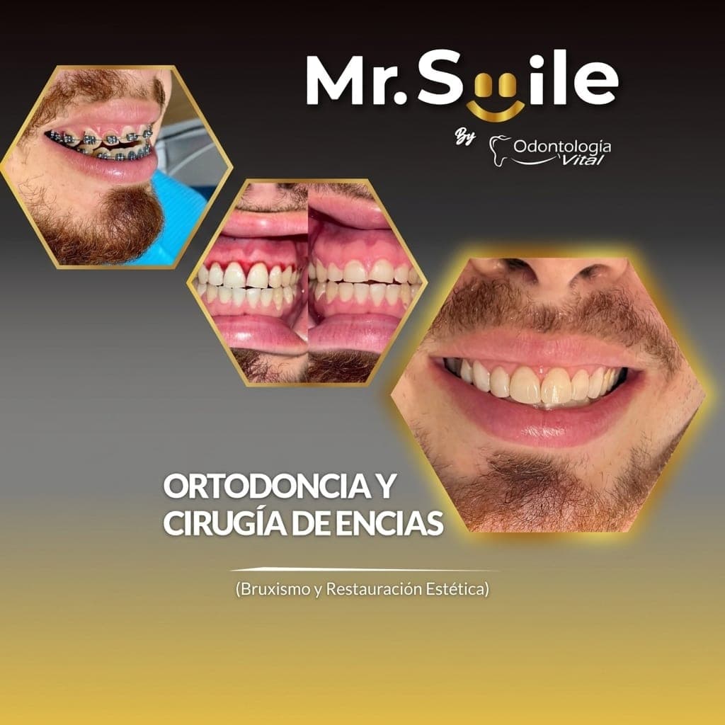 Mr Smile — ortodoncia